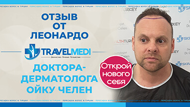 обзор через 9 месяцев после пересадки волос